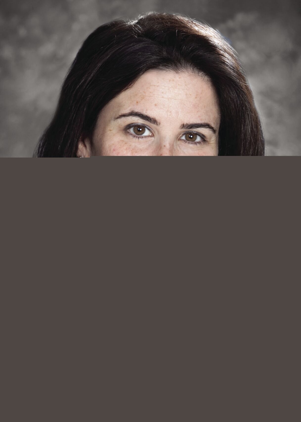 Ask the Doctor: What is a varicose vein?