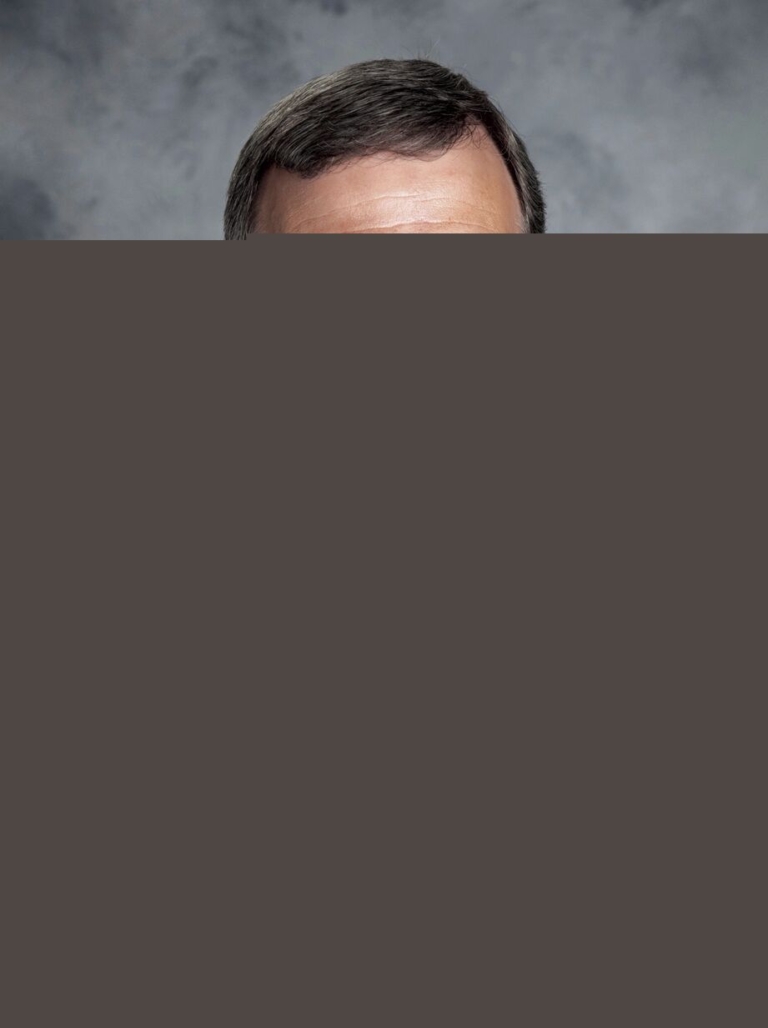 Ask the Doctor: When should I get moles examined?