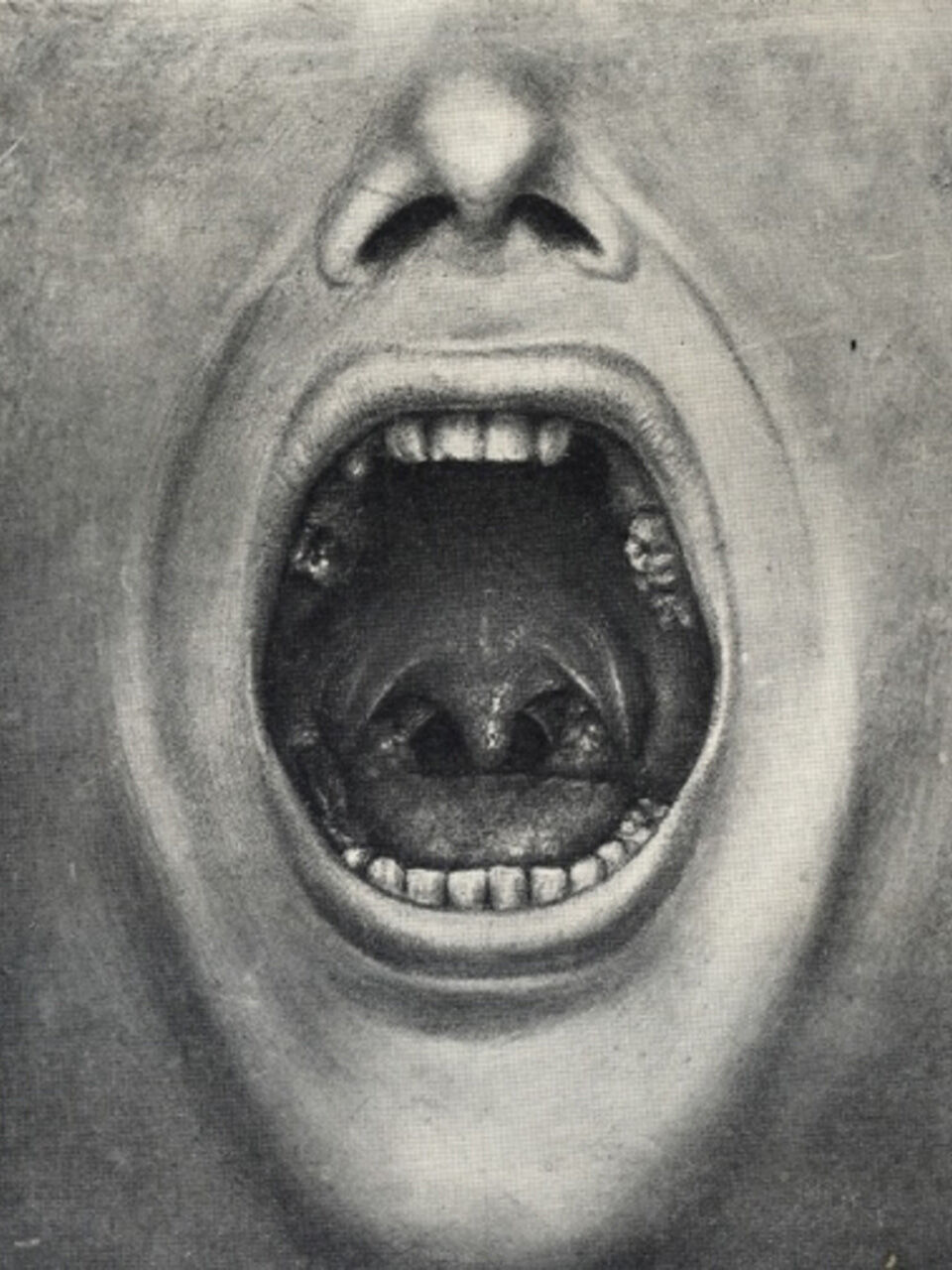 1 illustraion of Cotton’s book about removal of body parts to cure mental illness.