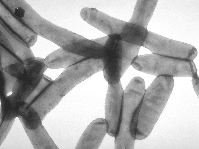 Legionella found in homes throughout Trenton Water Works service area